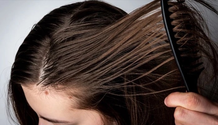 Causes of oily hair loss