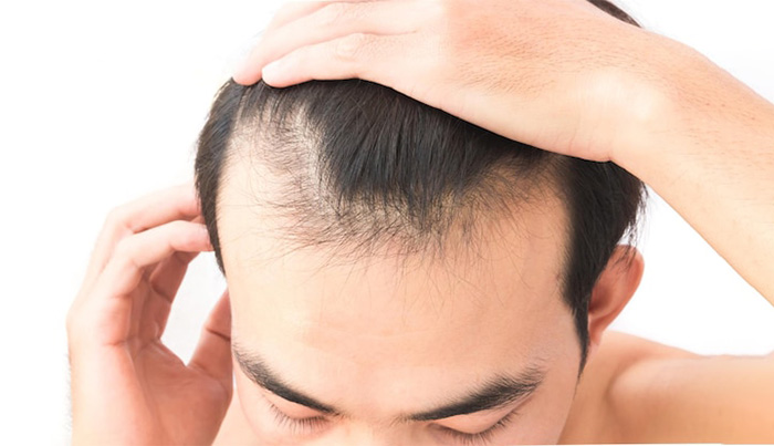 Reasons for hair loss